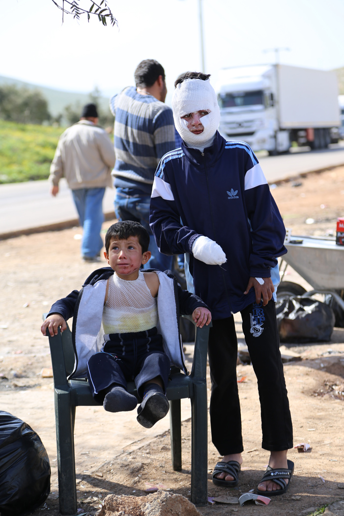 Evlerine düşen bomba hayatlarını kararttı Evlerine düşen bomba hayatlarını kararttı