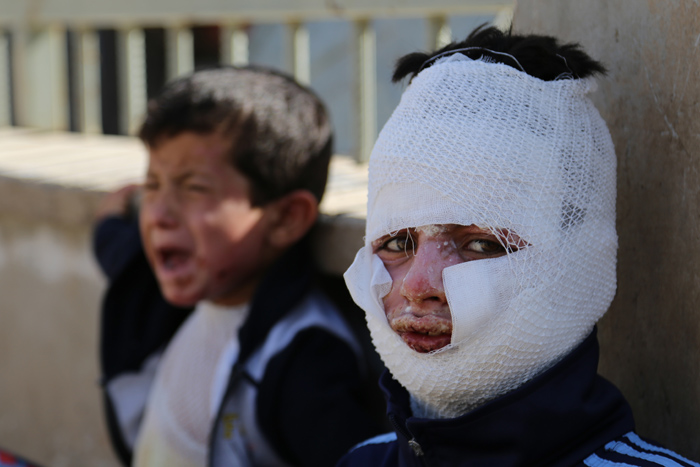 Evlerine düşen bomba hayatlarını kararttı Evlerine düşen bomba hayatlarını kararttı