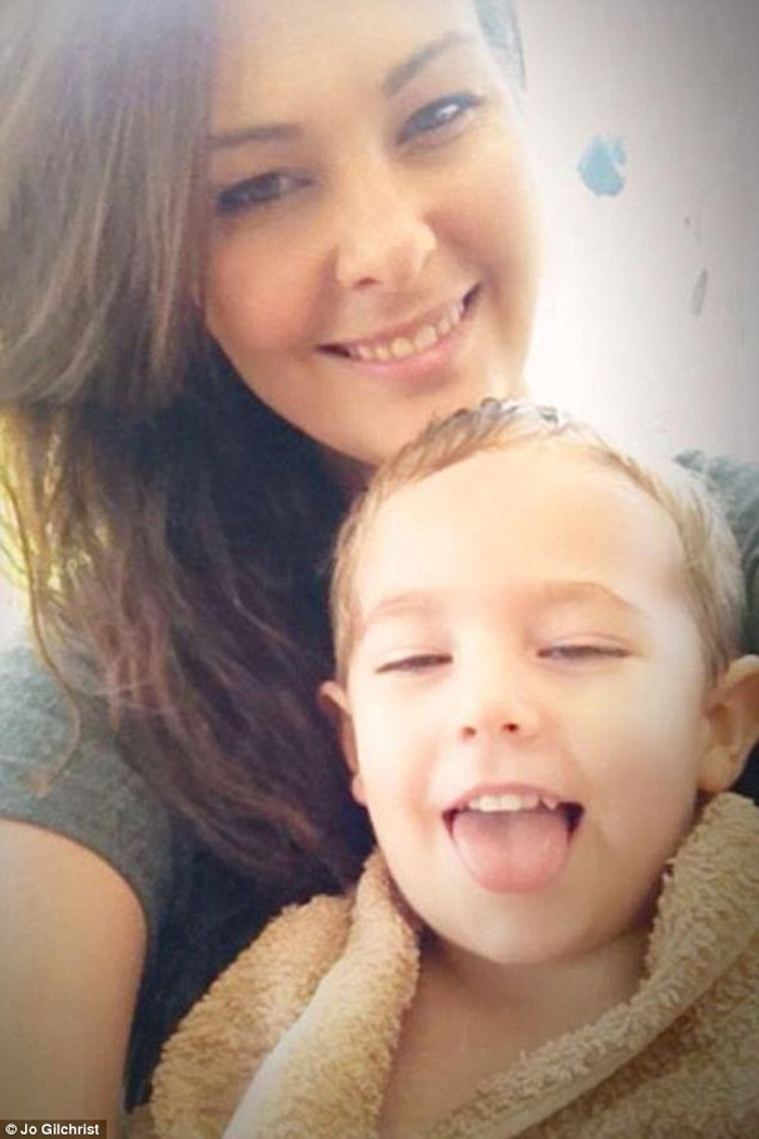 Sivilcesini makyajla kapatmak isterken kötürüm oldu Sivilcesini makyajla kapatmak isterken kötürüm oldu