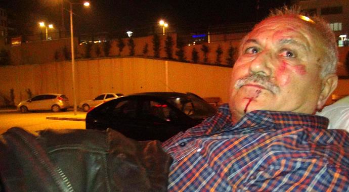 Babasını hastanelik etti Babasını hastanelik etti