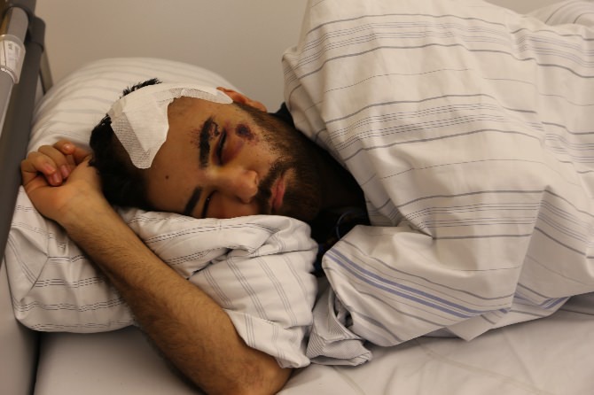 Almanya'da ırkçılar Türk gencini hastanelik etti! Almanya'da ırkçılar Türk gencini hastanelik etti!