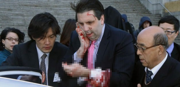 ABD Büyükelçisi'ne 'jiletli' saldırı ABD Büyükelçisi'ne 'jiletli' saldırı