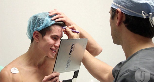 Ken gibi olmak için neredeyse kör olacaktı Ken gibi olmak için neredeyse kör olacaktı