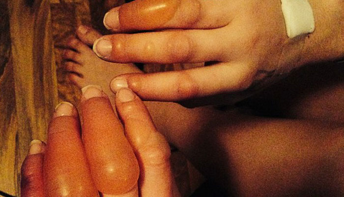 Uyandığında parmakları bu haldeydi!