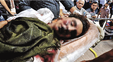 Bilyelerle güçlendirilmiş TNT bombası