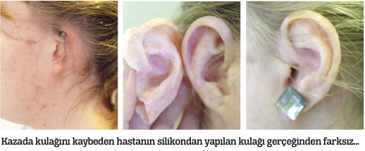 3D Teknolojisi ile vücudun yedek parçası üretiliyor 3D Teknolojisi ile vücudun yedek parçası üretiliyor