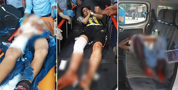 Diyarbakır'da kalleş saldırı: 2'si ağır 5 çocuk yaralı Diyarbakır'da kalleş saldırı: 2'si ağır 5 çocuk yaralı