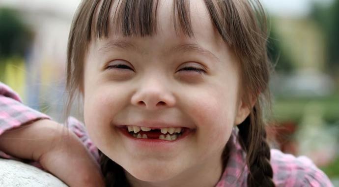 21 Mart Down Sendromu Farkındalık Günü (DOWN SENDROMU NEDİR) 21 Mart Down Sendromu Farkındalık Günü (DOWN SENDROMU NEDİR)