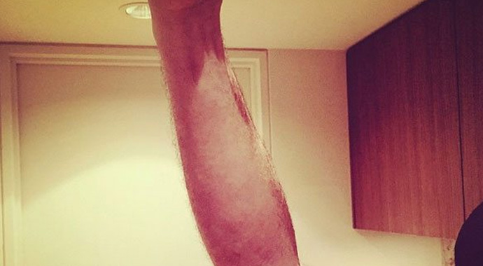 Ünlü rock yıldızı Edge sahneden düştü Ünlü rock yıldızı Edge sahneden düştü