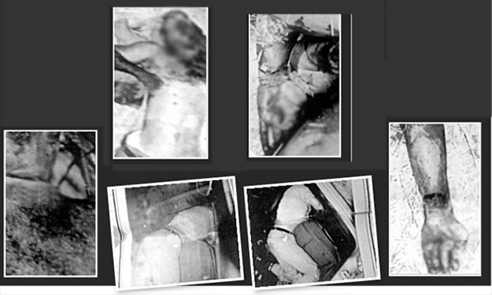 ASELSAN mühendisinin ölümüyle ilgili çarpıcı fotoğraflar ASELSAN mühendisinin ölümüyle ilgili çarpıcı fotoğraflar