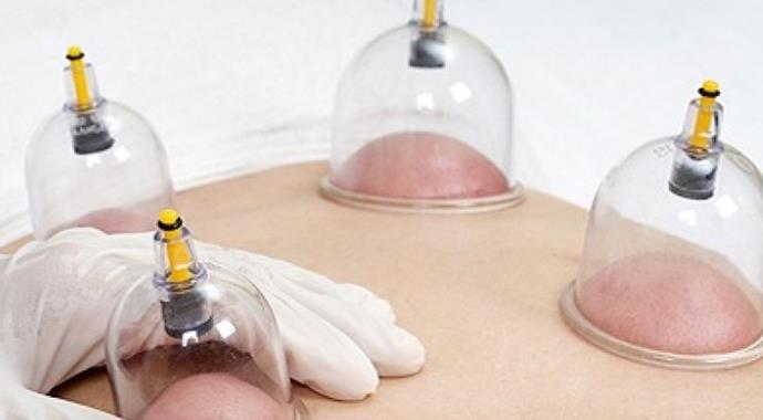 Hacamatın tam zamanı Hacamatın tam zamanı