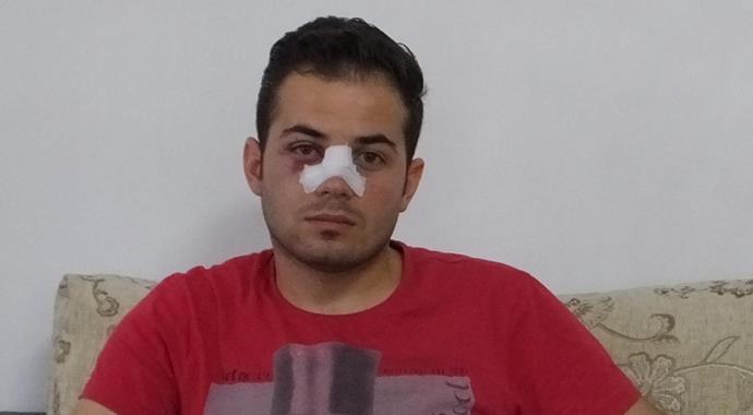 Kırmızı kart gösteren hakemin burnunu kırdı Kırmızı kart gösteren hakemin burnunu kırdı