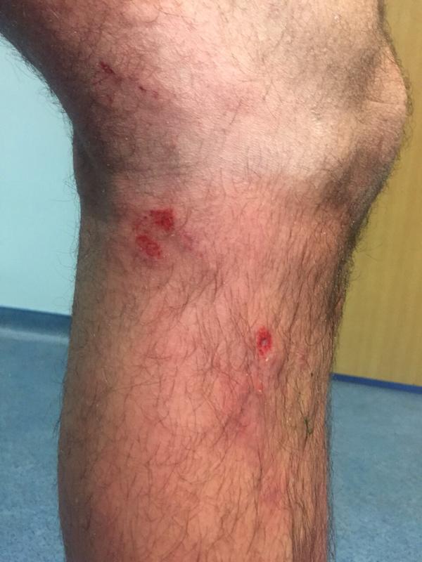 Fenerbahçe'den fotoğraflı isyan! Fenerbahçe'den fotoğraflı isyan!