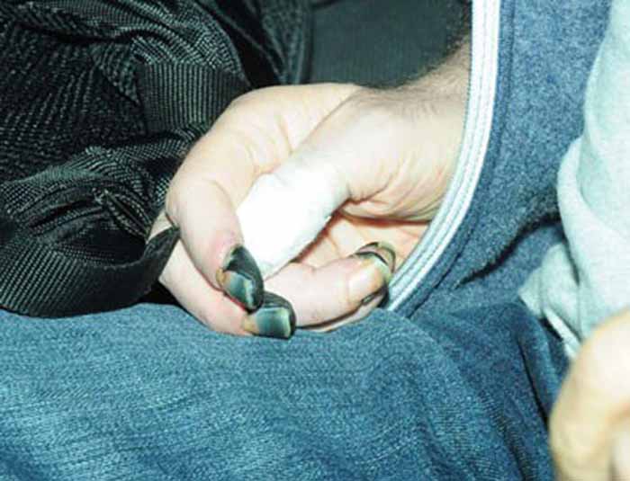 Nejat İşler'in parmakları kesildi mi, kesilmedi mi? Nejat İşler'in parmakları kesildi mi, kesilmedi mi? - 1. Resim