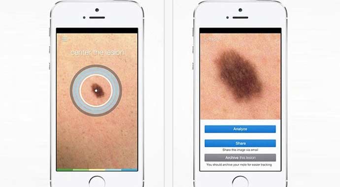 Bu uygulamayla Ben'iniz kanser mi öğrenebileceksiniz