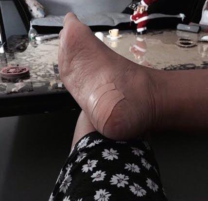 Demet Akalın'ın ayakları sosyal medyayı salladı