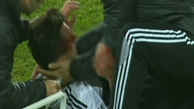 Mustafa Pektemek'ten kötü haber! Mustafa Pektemek'ten kötü haber!