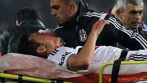 Mustafa Pektemek'ten kötü haber! Mustafa Pektemek'ten kötü haber!