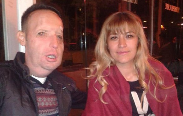 Yüz nakli olan Recep Sert'ten Seda Sayan'a tepki büyük!