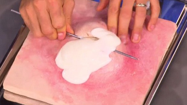 Mehmet Öz'den sivilce önerisi! Mehmet Öz'den sivilce önerisi!