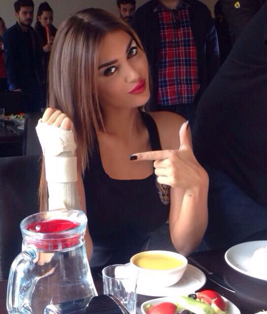 Yolanthe Cabau film setinde elini kırdı