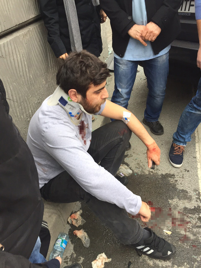 Ünlü sanatçının yeğeni kaza yaptı! Ünlü sanatçının yeğeni kaza yaptı!