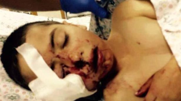 İsrail polisi 5 yaşındaki Cemal'i yüzünden vurdu